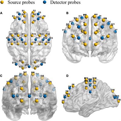 Effects of different exercise intensities of race-walking on brain functional connectivity as assessed by functional near-infrared spectroscopy